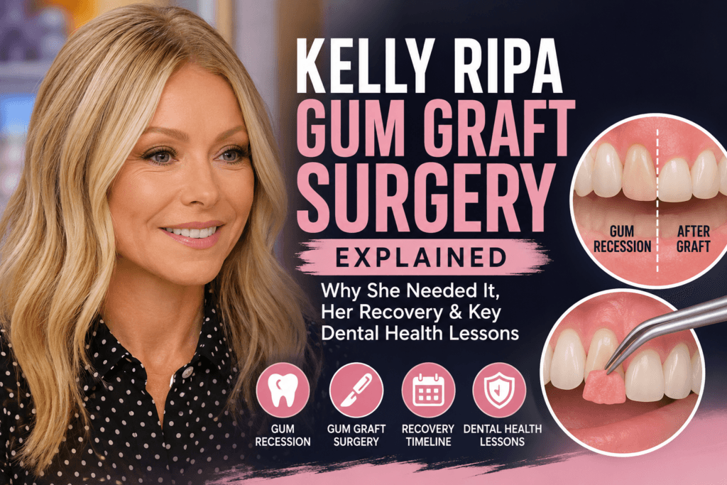 Kelly Ripa discussing gum graft surgery, gum recession, recovery, and dental health